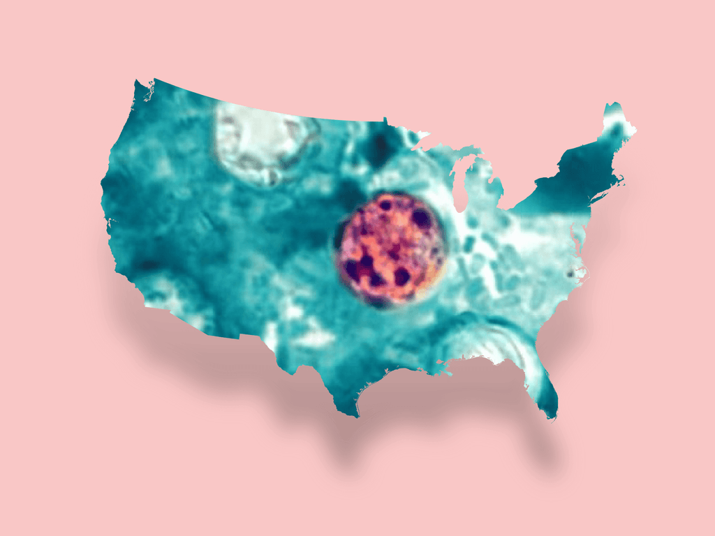 Cyclosporiasis cases in U.S. by July 31? card icon